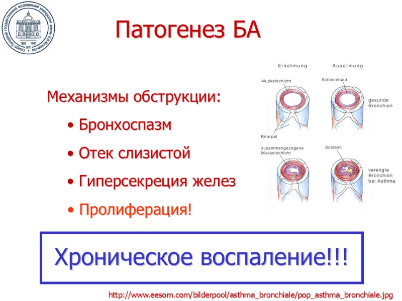 Патогенез БА Механизмы обструкции:  Бронхоспазм  Отек слизистой  Гиперсекреция желез  Пролиферация!